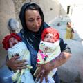 Hassina Mohammad and her twins were attacked with acid by militia.  